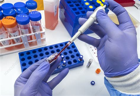 Blood analysis - Stock Image - F037/8044 - Science Photo Library