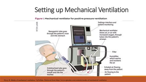 Basics of mechanical ventilator care | PPTX