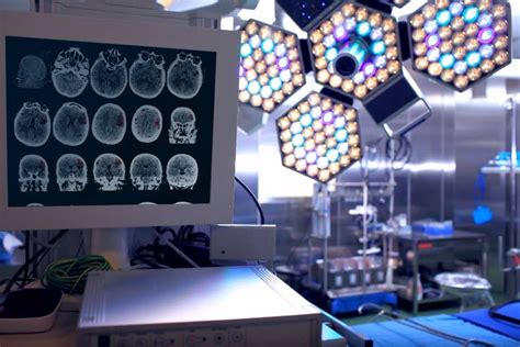 A Precise Reflection On Intraoperative Neurophysiological Monitoring