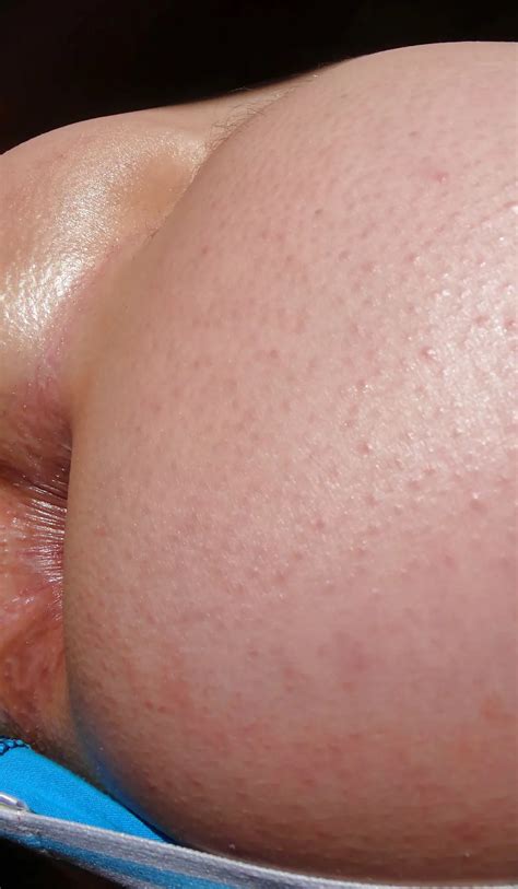 2011 Two Month Without Gaping My Asshole Closed 18 Nude Pics XHamster