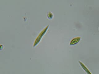 Amateur Algae culturing and cultivation : Ankistrodesmus acicularis for ...