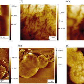 PDF Naked Mole Rat Hyaluronan An Extreme Folding Biopolymer