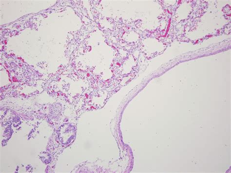 Lung Pleura Histology