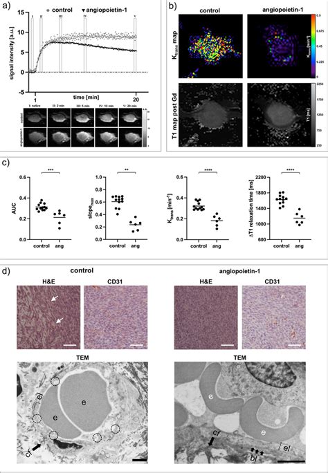 Analysis Of Vessel Stabilizing Angiopoietin 1 Treatment A Exemplary