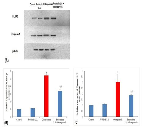 A Relative Protein Expression Levels Of Nlrp Inflammasome And