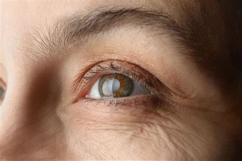 How Long Does Cataract Surgery Take Carolina Eyecare Physicians