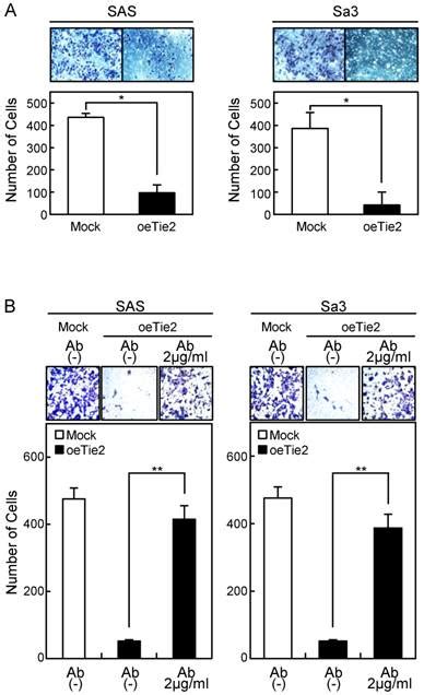 tie regulates tumor metastasis  oral squamous cell carcinomas
