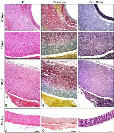 A I Histological Images Of Aortic Aneurysms At 3 7 And 15 Dps In