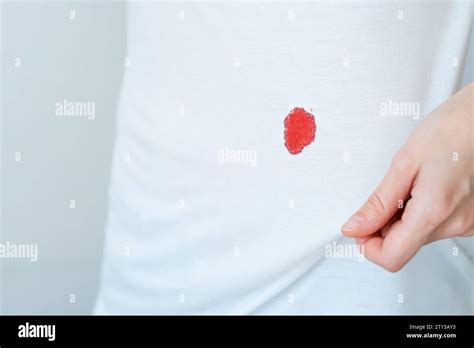 Drop stain of blood on a white cloth. Dirty stain for cleaning concept ...