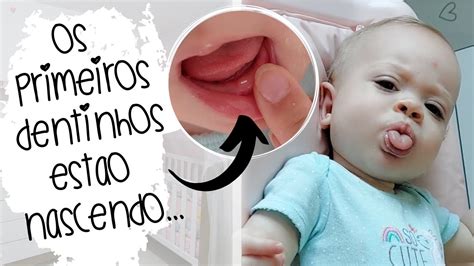 Primeiro Dentinho Do Bebê - NASCIMENTO DO PRIMEIRO DENTINHO DA BEBÊ | by Carla Soares - YouTube