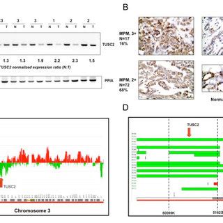 Down Regulation Of Tusc Expression In Mesothelioma A Tusc Mrna