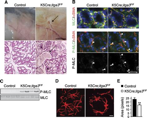 Control of mammary myoepithelial cell contractile function by α3β1