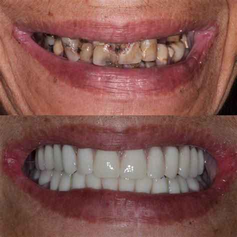 White Teeth Solutions