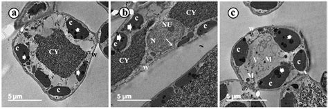 Transmission electron micrographs of grapevine leaf cells infected by... | Download Scientific ...