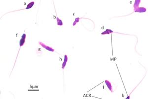 Sperm Competition Or Lack Of Sperm Competition Ht Casa