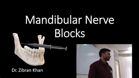 Mandibular Nerve Blocks Full Lecture Youtube