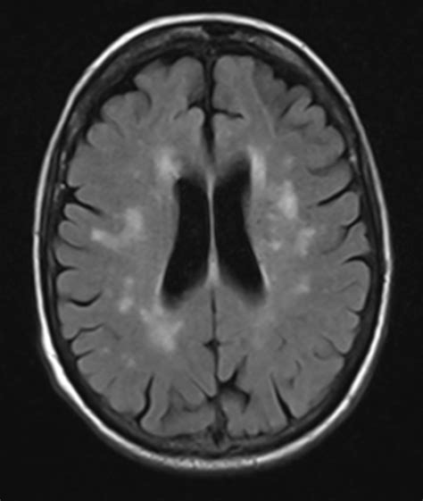 Magnetresonanztomografie Mrt Radiologie Filstal