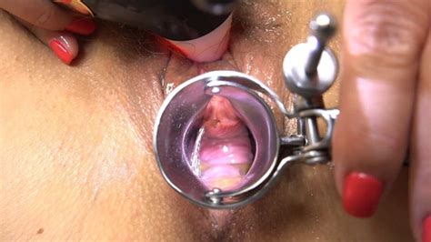 Free Speculum Porn Videos Xhamster