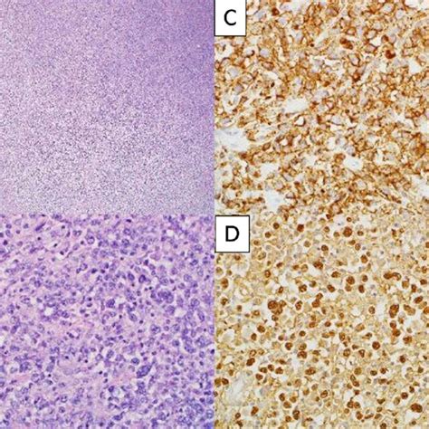 Hematoxylin And Eosin He Staining Immunohistochemical Staining And Download Scientific