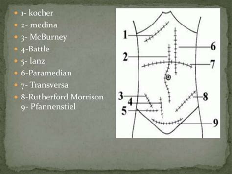 Abdomen Layers And Surgical Incisions