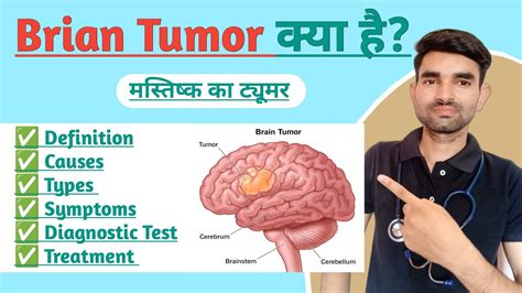 Brain Tumor In Hindi Causes Types Symptoms And Treatment Of Brain