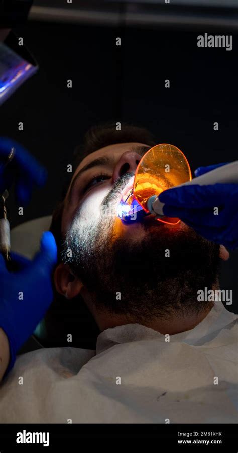 Tooth Decay Prevention Man In The Dentist Chair During A Dental