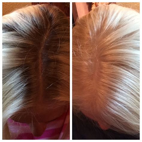 Olaplex Before And After Blonde Hair Olaplex Olaplex Hair Treatment Hair Treatment Hair Care