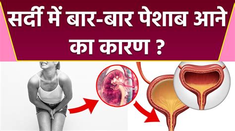 ठंड में बार बार पेशाब आना High Bp का कारण Frequent Urination In Winter