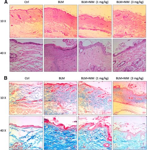 Restoration Of Lung Architecture And Collagen Depostion By NIM A