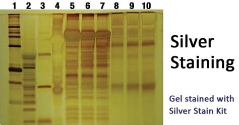 Silver Staining Principle Procedure Applications Microbe Notes