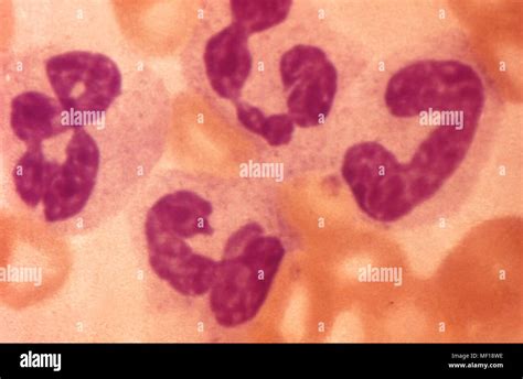 Neutrofilos segmentados fotografías e imágenes de alta resolución Alamy