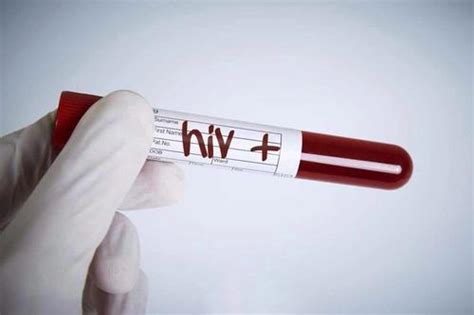 Hiv Dna检测结果179，艾滋病dna检测没有定量检测艾滋病检测艾测网