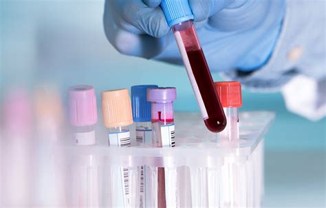 blood tests  diagnosing illness   blood    whats happening   body