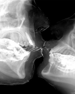 Sex Under Mri Or Xray Porn Pictures XXX Photos Sex Images PICTOA