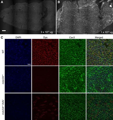 In Vivo Genome Editing Restores Dystrophin Expression And Cardiac