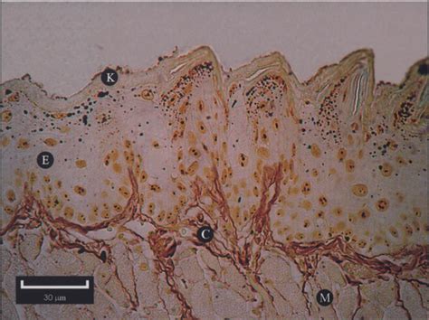Photomicrograph Of Tongue Mucosa Silver Stained Showing Keratin Layer