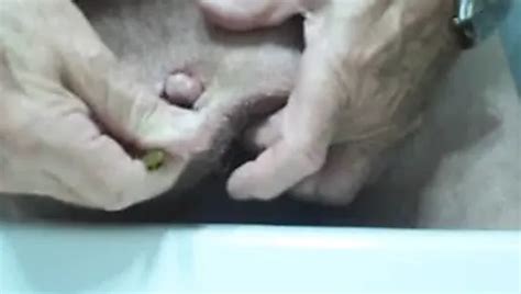 Penectomy Free Solo Man Porn Video B Xhamster