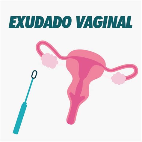 Exudado Vaginal Laboratorio M Dico Samalab