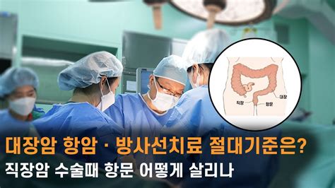 대장암 항암ㆍ방사선치료 절대기준은 직장암 수술때 항문 어떻게 살리나 Youtube