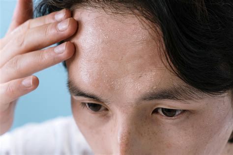 Why do I sweat under eyes?