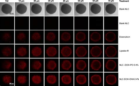 Confocal Images Of MCF 7 Adr Tumor Spheroids After Incubation For 2 H