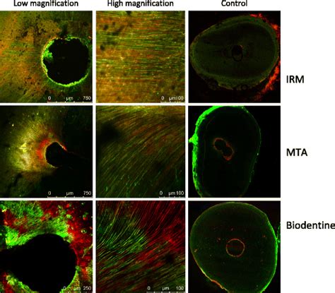 Confocal Laser Scanning Microscopy Clsm Images Of Experimental And