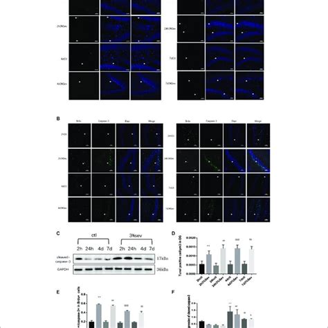 A LC3B Inhibitor Alleviated Sevoflurane Induced Cleaved Caspase 3