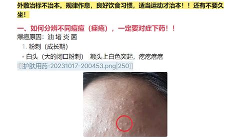 【已解决】被obsidian的图片问题整崩溃了 疑问解答 Obsidian 中文论坛