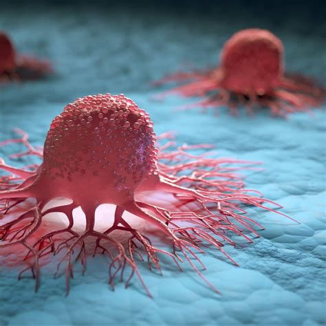 overview  treatment  tumors healing consulting turkey