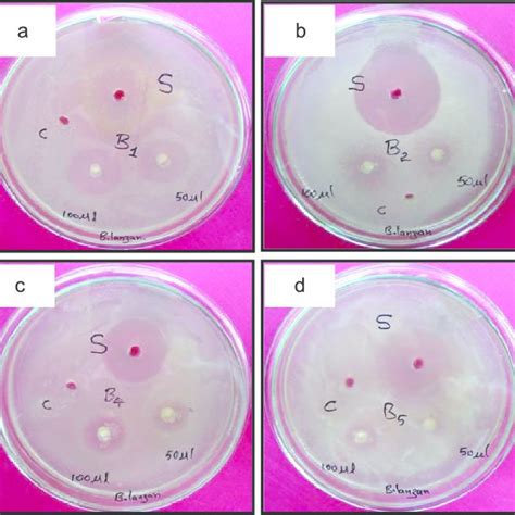 Zone Of Inhibition Of A Klebsiella Aerogenes B Escherichia Coli C