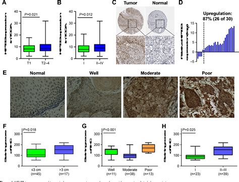 Figure From Kif B Promotes Tumor Progression Through Activating The