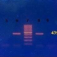 Ethidium Bromide Stained Agarose Gel Showing The Expected Band Of The