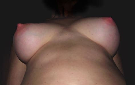 Skin Shoulder Joint Back Neck Porn Pic