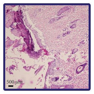 Skin Tissue Histopathological Assessment Of Different Rat Groups At The